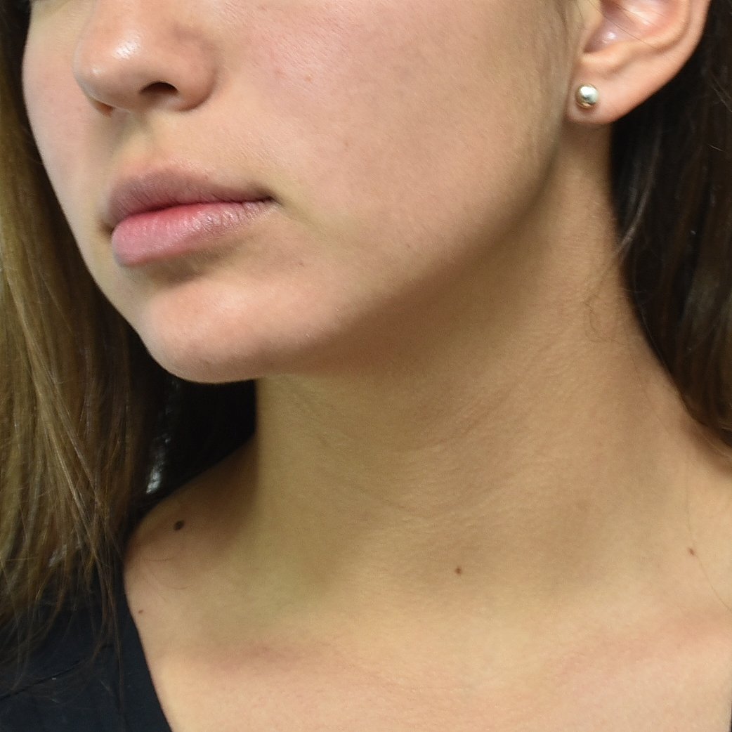 Arete de Bola-Silver Earrings-Plarte New